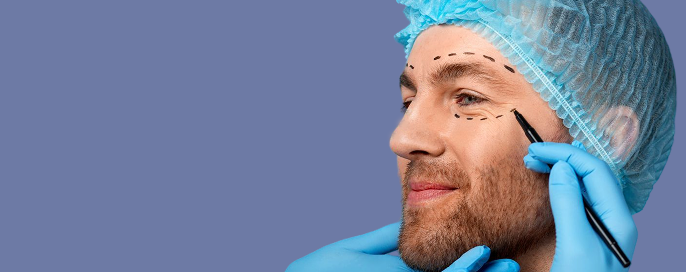 blepharoplasty treatment
