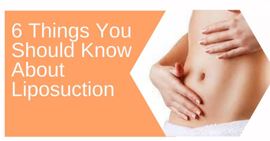 Liposuction Surgery - Karishma Cosmetic Clinic