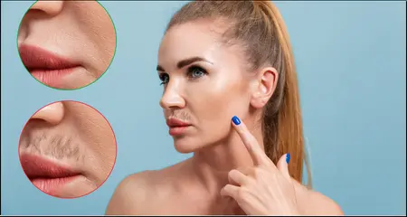 laser hair removal treatment- before - after- result- facial hairs