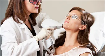 laser hair removal treatment on face- chin