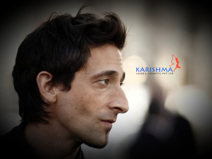 What Are The Types Of Noses