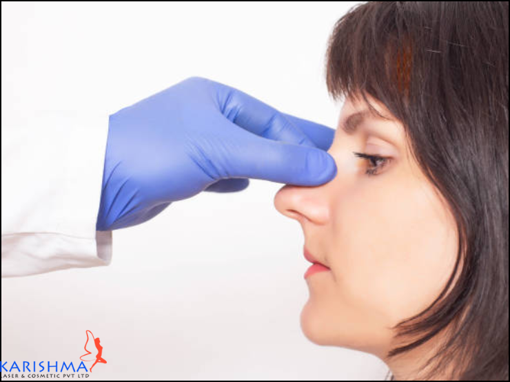 How Many Types Of Nose