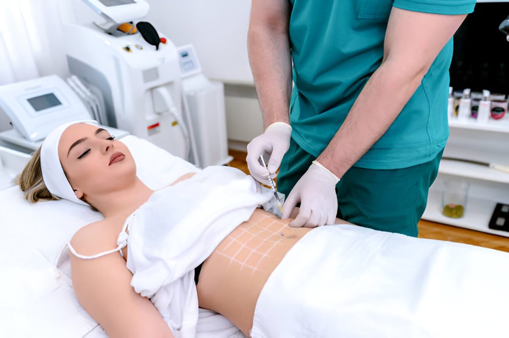 What is Laser Liposuction