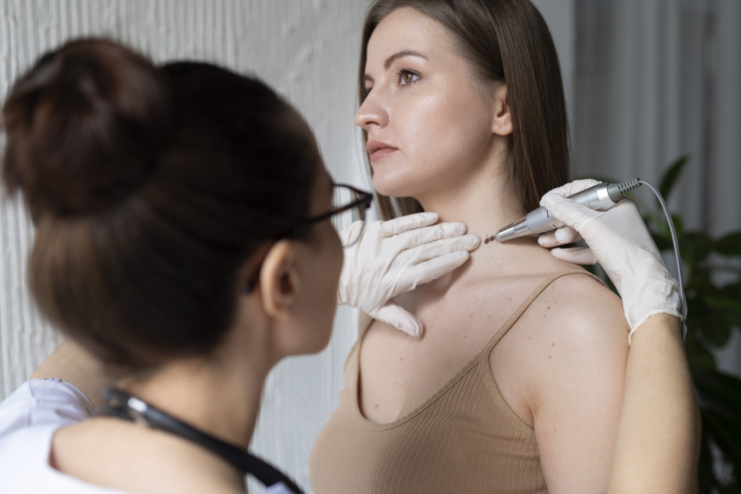 Safe skin tag removal procedure